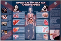 Электрифицированный стенд "Вредные привычки: алкоголизм" - «globural.ru» - Брянск