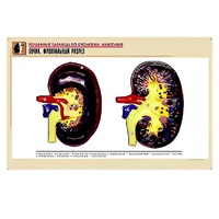 Рельефная таблица "Почка. Фронтальный разрез" (формат А1, матовое ламинир.) - «globural.ru» - Брянск